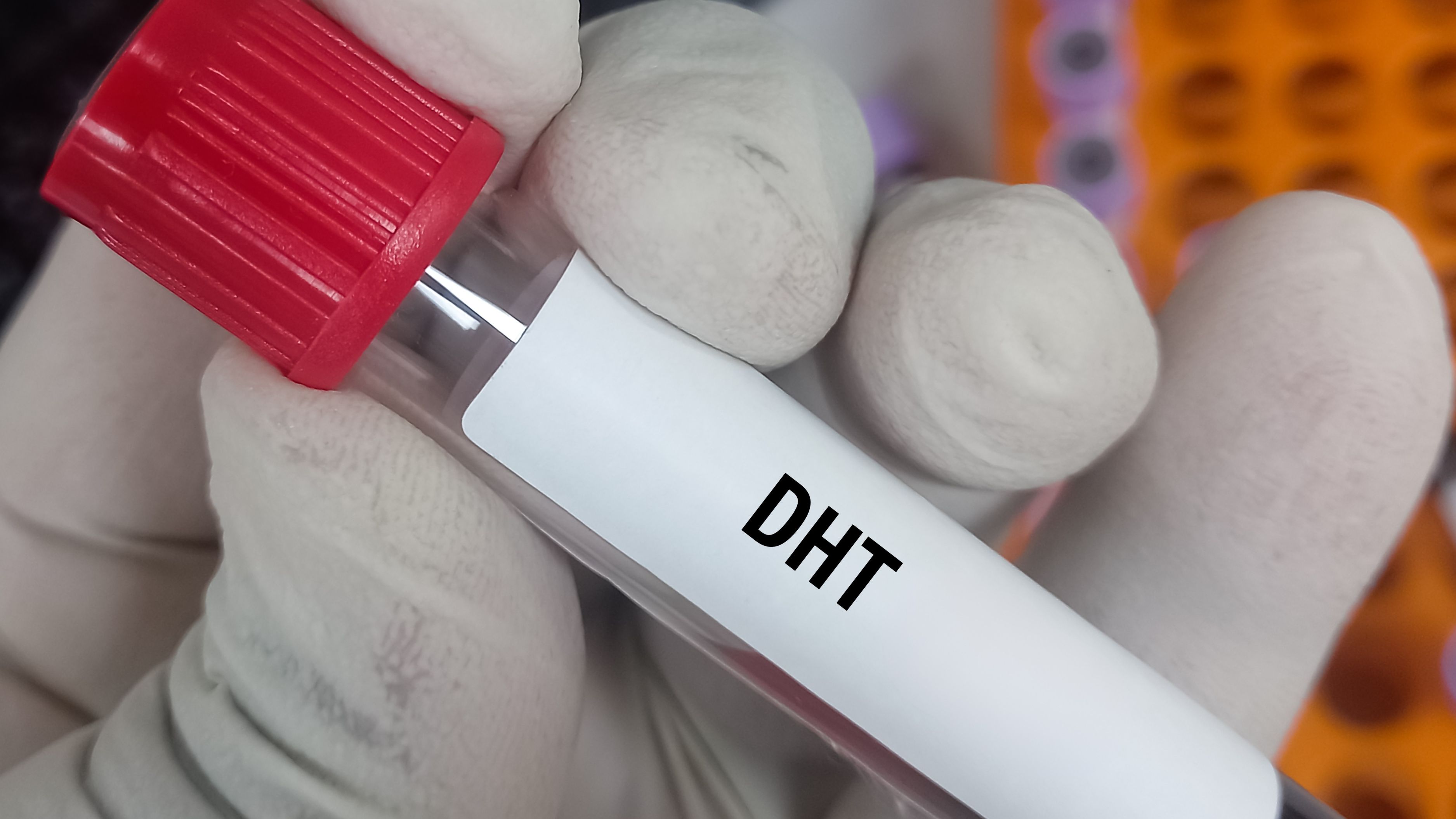 Why Your Dht-To-Testosterone Ratio Matters More Than You Think